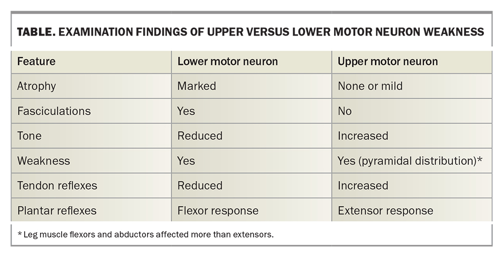 sudden-leg-weakness-where-is-the-problem-what-is-the-cause